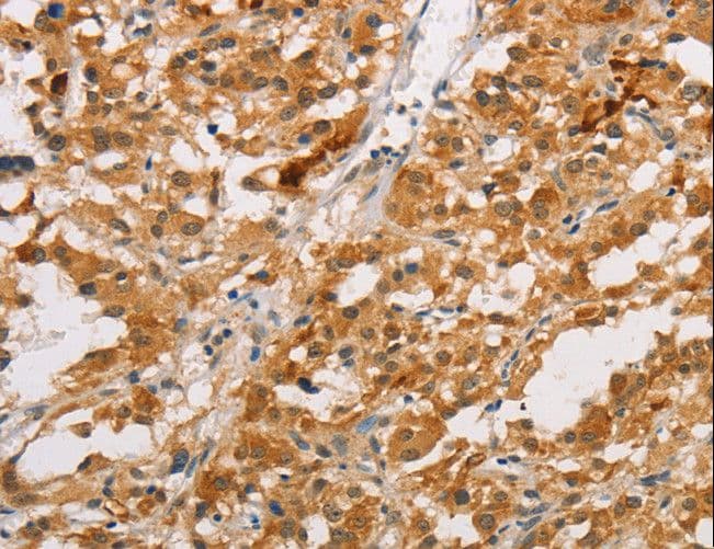 Polyclonal Rabbit anti-Human ARMCX3 Antibody (IHC)