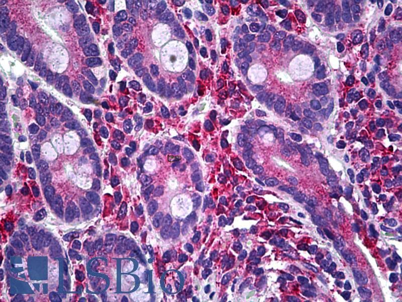 IHC-plus™ Monoclonal Mouse anti-Human LIMK1 / LIMK Antibody (clone 2E9, IHC, WB)