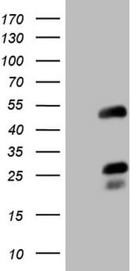 EAR2 / NR2F6 Antibody (clone OTI2C9)