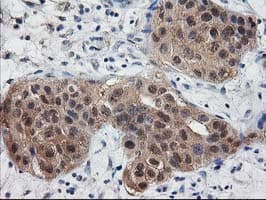 DSTN / Destrin Antibody (clone OTI1C8)