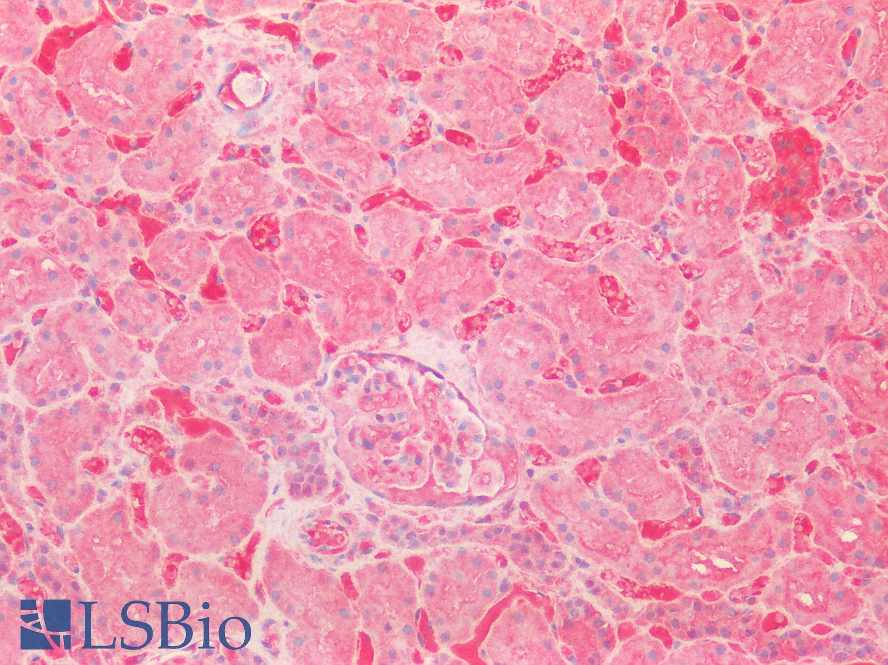 PathPlus™ SOD2 / Mn SOD Antibody (aa77-91)