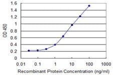 IHC-plus™ Monoclonal Mouse anti-Human CYB5A / Cytochrome b5 Antibody (clone 1A8, IHC, WB)