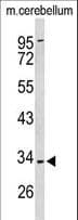 PEX2 / PAF-1 Antibody (aa165-194)