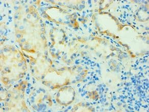 SLC4A2 / AE2 Antibody (aa95-245)