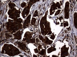 NME1 / NM23 Antibody (clone OTI6E8)