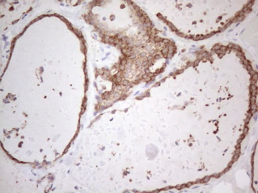 PODXL / Podocalyxin Antibody (aa32-461, clone OTI2C6)
