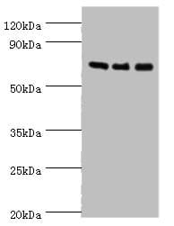 AKAP10 Antibody (aa413-662)