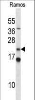 COPS8 / COP9 Antibody (aa1-30)