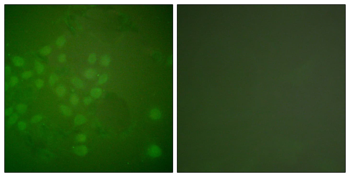 RAD17 Antibody (aa621-670)