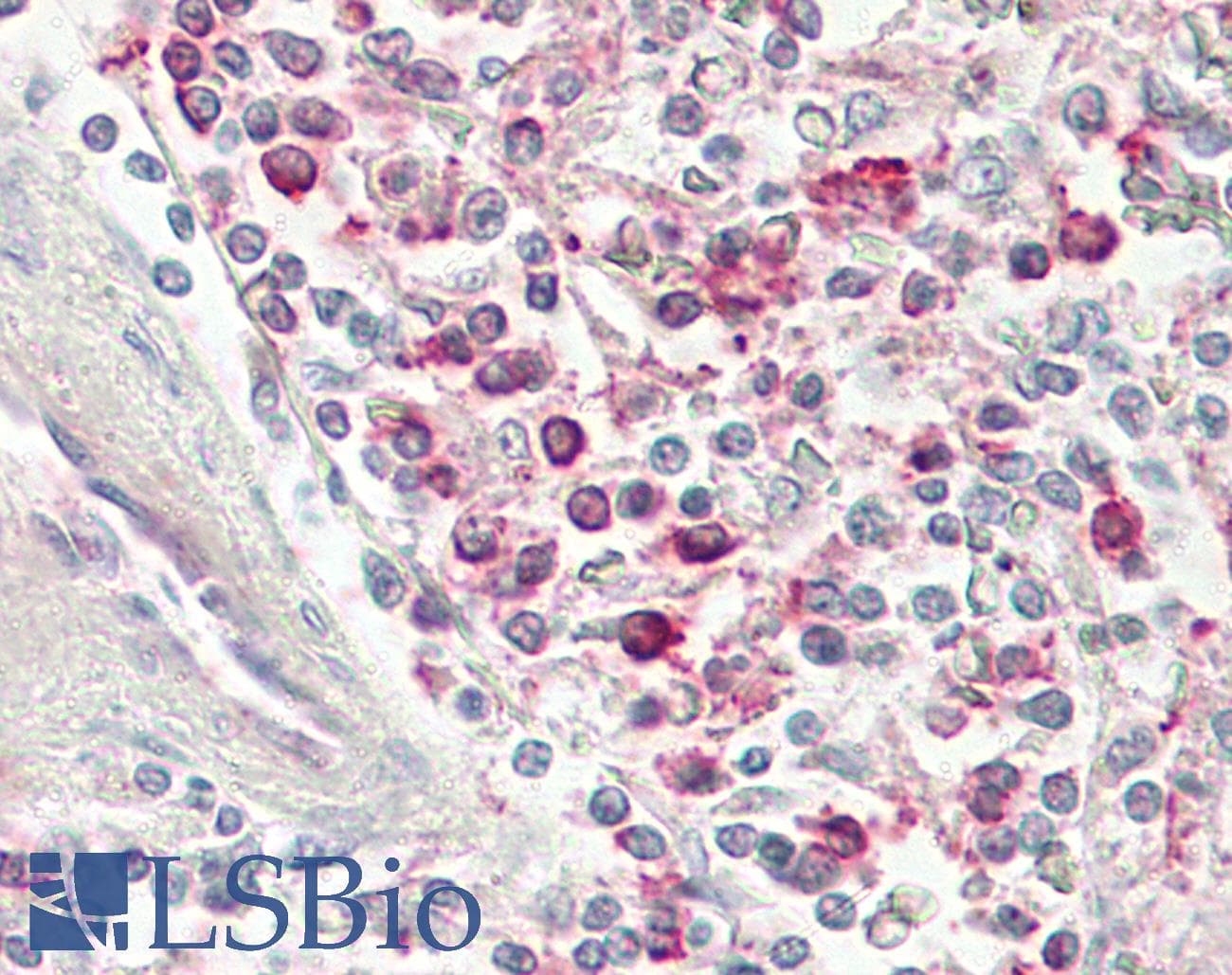 IHC-plus™ CCR4 Antibody (N-Terminus)