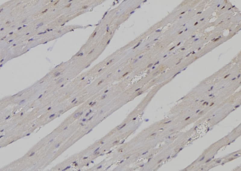 Polyclonal Rabbit anti-Human PTBP1 Antibody (IHC, WB)
