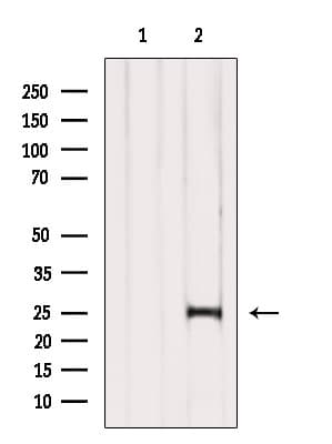 COMMD5 Antibody