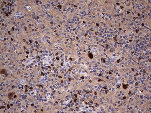 MKI67 / Ki67 Antibody (aa1160-1493, clone OTI1D9)