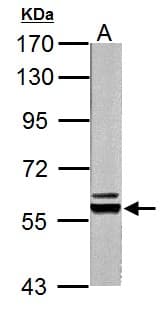 PKLR Antibody (aa1-260)