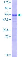 Human UCHL5 / UCH37 Protein (Recombinant GST)