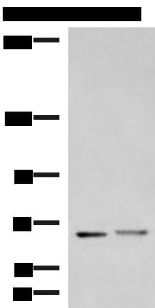 Polyclonal Rabbit anti-Human EXD2 Antibody (IHC, WB)