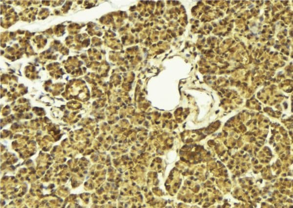 Polyclonal Rabbit anti-Human FOXO4 / AFX1 Antibody (IHC, IF, WB)