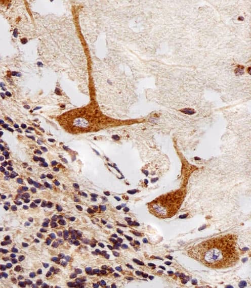 PPT1 / CLN1 Antibody (aa1-306, clone 1117CT11.2.1.4)