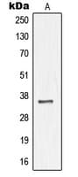 Polyclonal Rabbit anti-Human NKX3-1 Antibody (N-Terminus, IHC, WB)