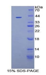 Human IGFBP1 Protein (Recombinant His-GST)