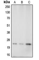 Polyclonal Rabbit anti-Human CAV1 / Caveolin 1 Antibody (N-Terminus, WB)