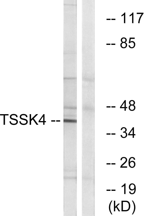 TSSK4 / TSSK5 Antibody (aa211-260)
