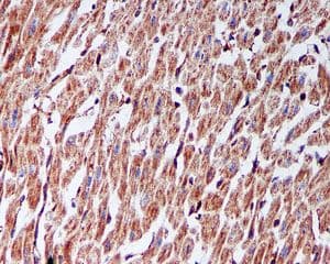 IHC-plus™ FADS1 Antibody (Internal, clone EPR6898)