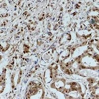 Polyclonal Rabbit anti-Human GAPDH Antibody (IHC, WB)