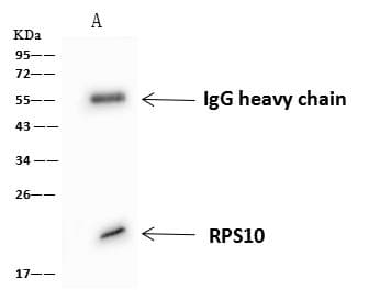 RPS10 / Ribosomal Protein S10 Antibody