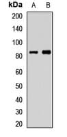 CEP83 / CCDC41 Antibody