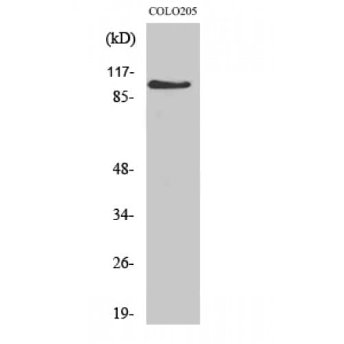 Polyclonal Rabbit anti-Human MLLT10 Antibody (180-260 aa, Internal, IHC, IF, WB)
