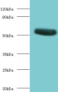 CHRNA1 Antibody