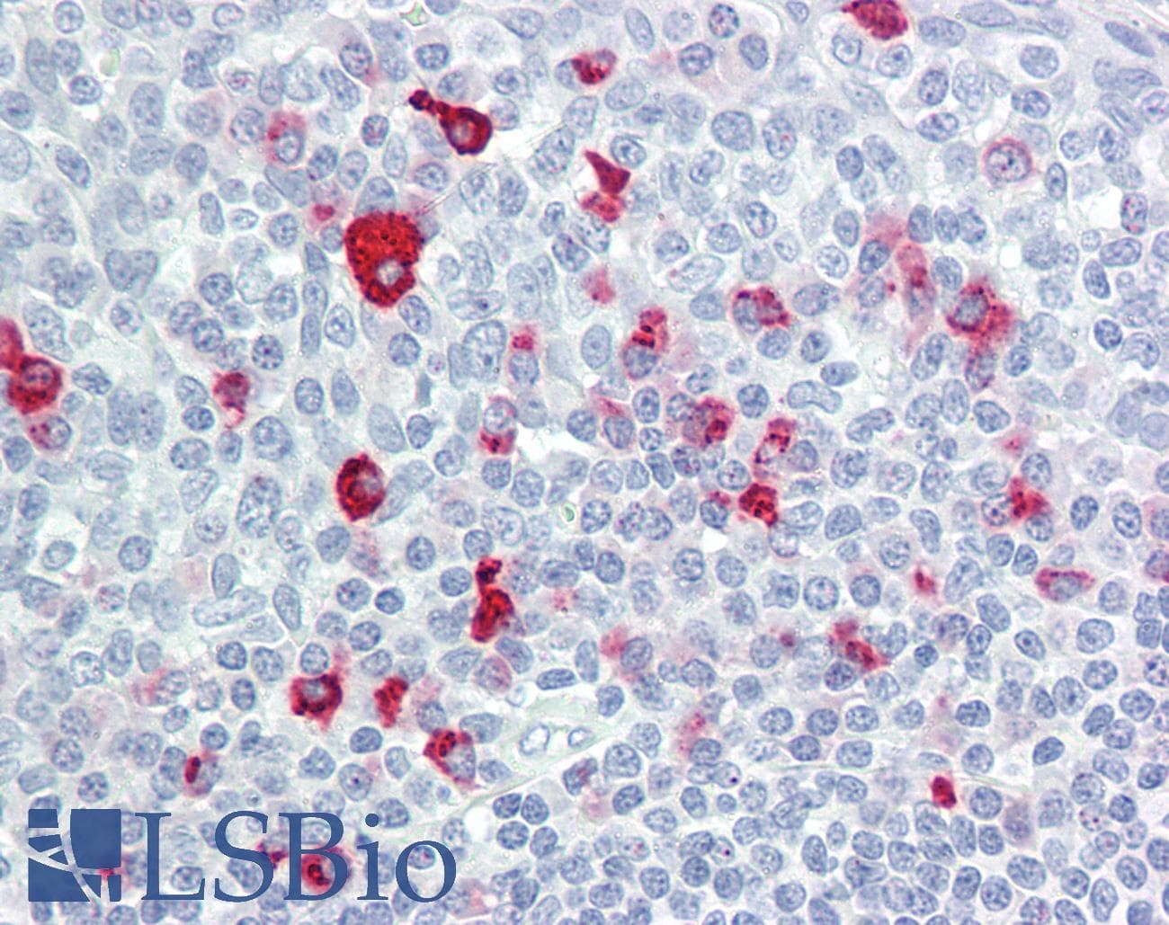 IHC-plus™ BTBD6 Antibody (aa91-140)