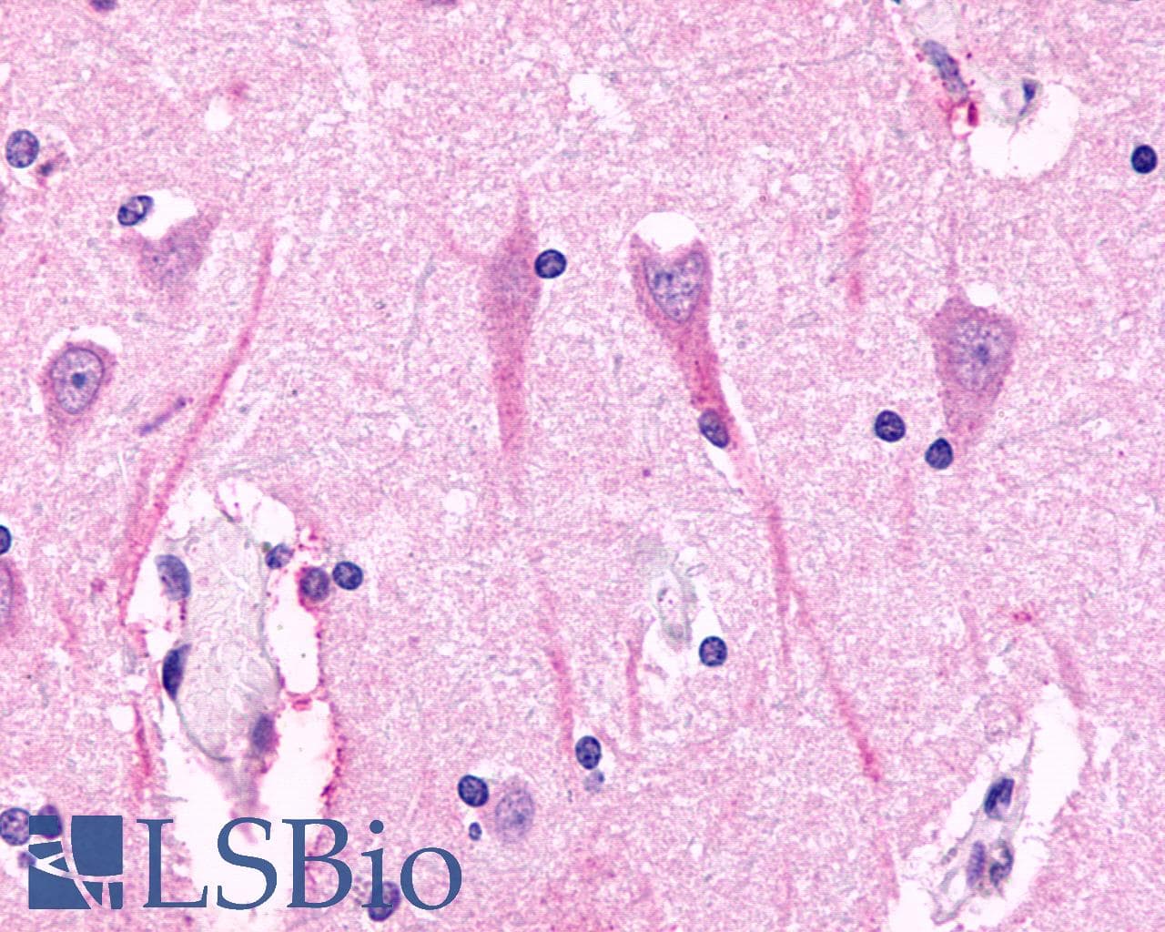 PathPlus™ ADGRV1 / GPR98 Antibody (N-Terminus)