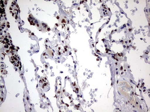 HNRPM / HNRNPM Antibody (aa1-261, clone OTI4C9)