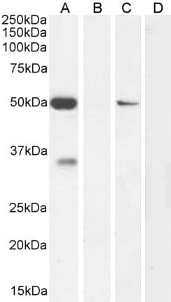 IHC-plus™ Polyclonal Goat anti-Human KCNN4 / KCa3.1 Antibody (aa227-239, IHC, IF, WB)
