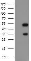 SNAI2 / SLUG Antibody (clone OTI1A6)