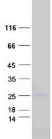 Human CAV3 / Caveolin 3 Protein (Recombinant Myc-DDK (Flag))