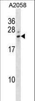 Polyclonal Rabbit anti-Human LCN8 Antibody (aa111-140, WB)