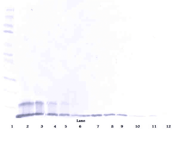 TNFRSF10B / Killer / DR5 Antibody