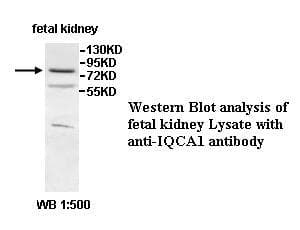 Polyclonal Rabbit anti-Human IQCA Antibody (aa178-367, IHC, WB)