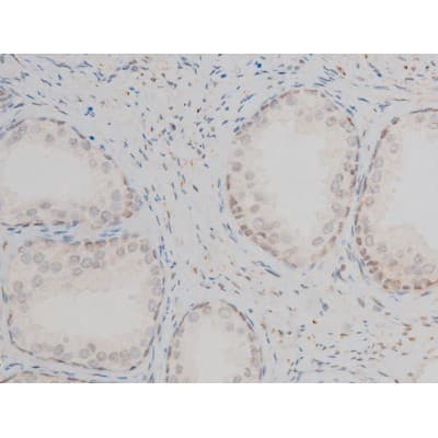 GATA1 Antibody (phospho-Ser142)