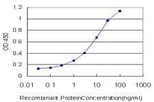 IHC-plus™ LIG1 / DNA Ligase 1 Antibody (clone 10G12)