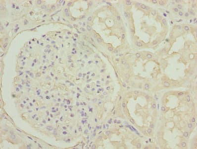 Polyclonal Rabbit anti-Human POSTN / Periostin Antibody (IHC, WB)