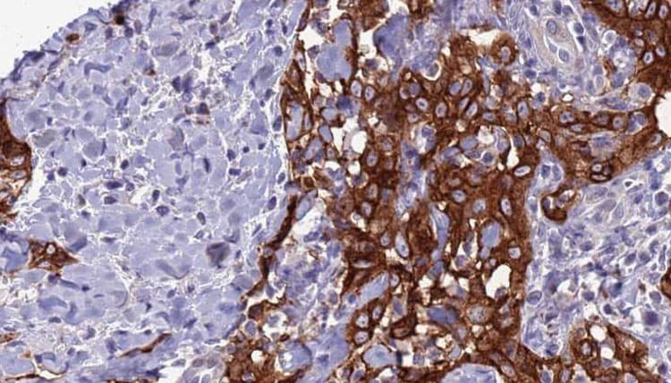 SYP / Synaptophysin Antibody