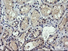 SOLO / SESTD1 Antibody (clone OTI4B10)