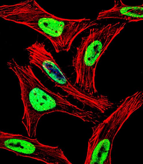 EWSR1 / EWS Antibody (aa623-652)