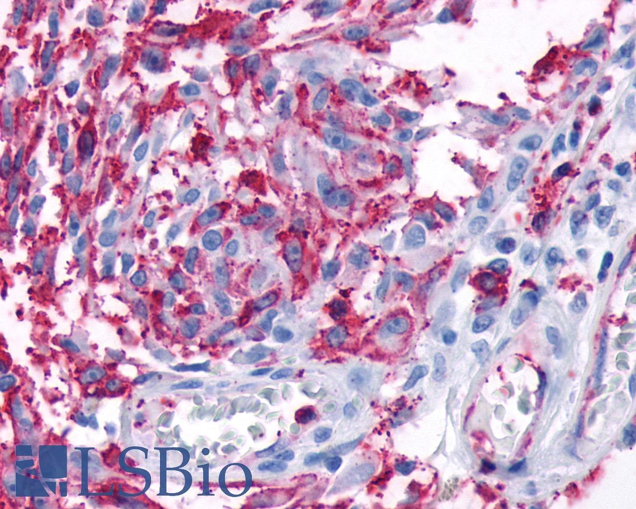 PathPlus™ Polyclonal Rabbit anti-Human FZD3 / Frizzled 3 Antibody (IHC)