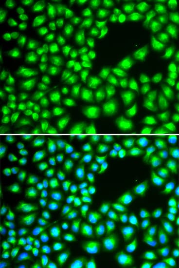 Polyclonal Rabbit anti-Human ERCC1 Antibody (IHC, IF, WB)