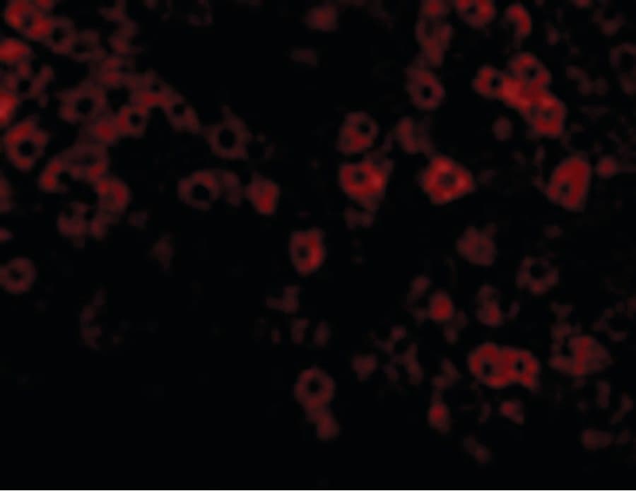 Polyclonal Rabbit anti-Human PLIN3 / M6PRBP1 / TIP47 Antibody (IHC, IF, WB)